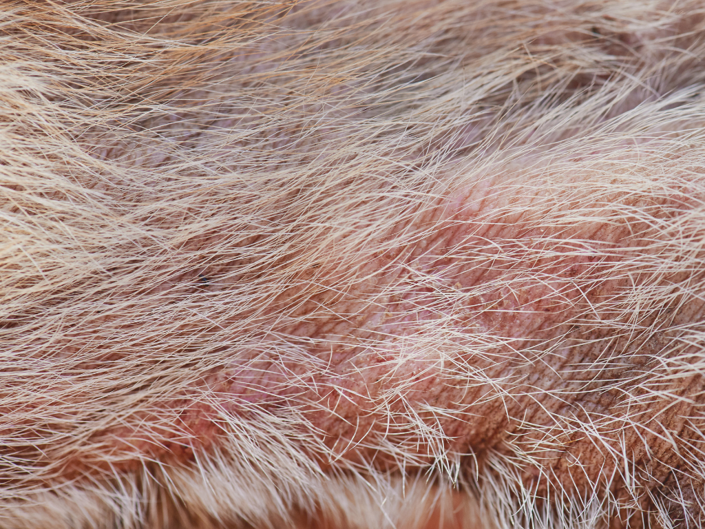 角化型疥癬の症例